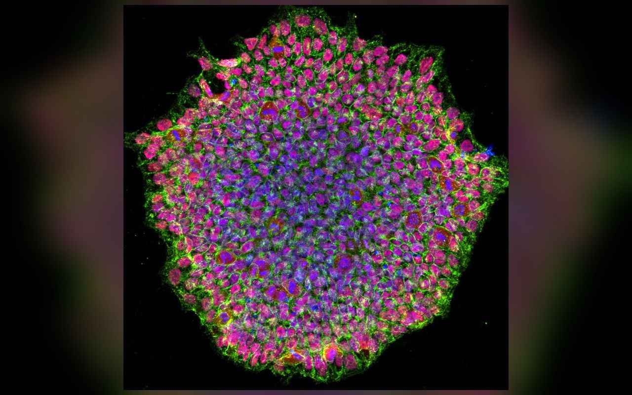 人类诱导多能干细胞集落的显微图像